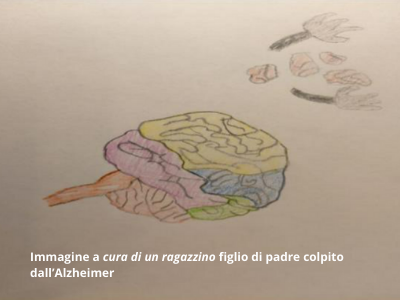 Cervello e Alzheimer